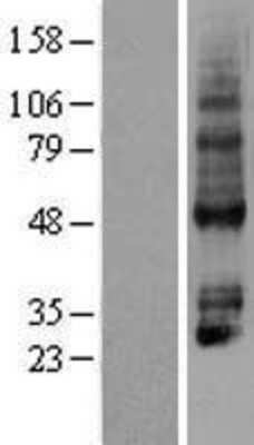 Western Blot P2Y4/P2RY4 Overexpression Lysate