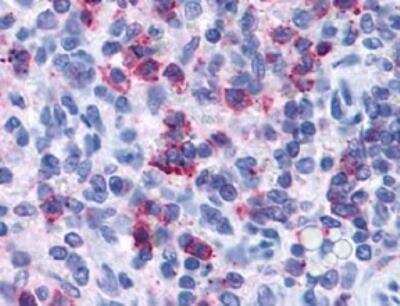 Immunohistochemistry-Paraffin: P2Y4/P2RY4 Antibody [NLS5011] - Analysis of anti-P2RY4 / P2Y4 antibody with spleen at 64 ug/ml.
