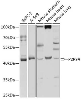 Western Blot P2Y4/P2RY4 Antibody - BSA Free