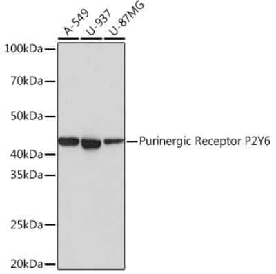 Western Blot: P2Y6/P2RY6 Antibody (4I8C9) [NBP3-16259] - Western blot analysis of extracts of various cell lines, using Purinergic Receptor P2Y6/P2RY6 Rabbit mAb (NBP3-16259) at 1:1000 dilution. Secondary antibody: HRP Goat Anti-Rabbit IgG (H+L) at 1:10000 dilution. Lysates/proteins: 25ug per lane. Blocking buffer: 3% nonfat dry milk in TBST. Detection: ECL Basic Kit. Exposure time: 1s.