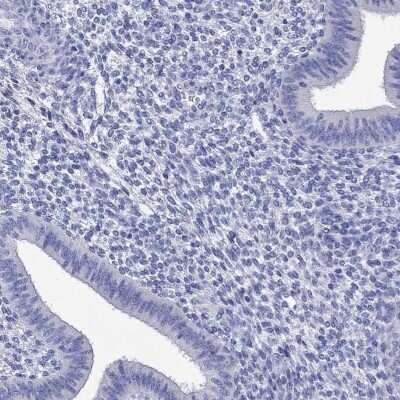 Immunohistochemistry-Paraffin: P2Y6/P2RY6 Antibody [NBP3-17041] - Staining of human endometrium shows low expression as expected.