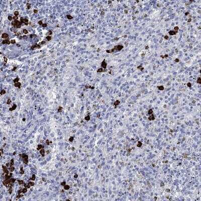 Immunohistochemistry-Paraffin: P2Y6/P2RY6 Antibody [NBP3-17041] - Staining of human spleen shows high expression.