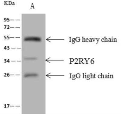Immunoprecipitation: P2Y6/P2RY6 Antibody [NBP2-99485] - P2Y6/P2RY6 was immunoprecipitated using: Lane A: 0.5 mg HepG2 Whole Cell Lysate 4 ul anti-P2Y6/P2RY6 rabbit polyclonal antibody and 60 ug of Immunomagnetic beads Protein A/G.  Primary antibody: Anti-P2Y6/P2RY6 rabbit polyclonal antibody, at 1:100 dilution. Secondary antibody: Goat Anti-Rabbit IgG (H+L)/HRP at 1/10000 dilution. Developed using the ECL technique. Performed under reducing conditions. Predicted band size: 36 kDa. Observed band size: 35 kDa