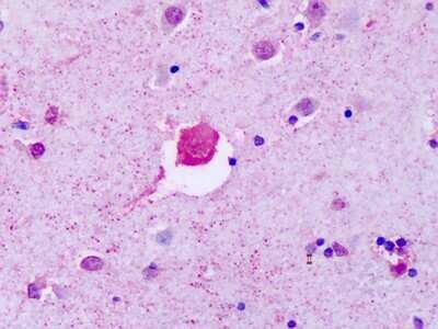 Immunohistochemistry-Paraffin: P2Y8 Antibody [NLS1918] - Analysis of anti-P2RY8 antibody with human brain, cortex at concentration 20-40 ug/ml.