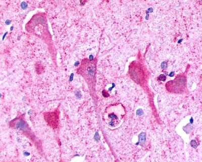 Immunohistochemistry-Paraffin: P2Y8 Antibody [NLS1921] - Analysis of anti-P2RY8 / P2Y8 antibody with human brain, neurons and glia at 2 ug/ml.