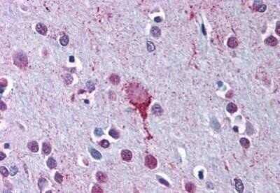 Immunohistochemistry-Paraffin: P2Y9 Antibody - BSA Free [NBP1-02406] - Staining of human brain, cortex after heat-induced antigen retrieval. Antibody concentration 20 ug/ml.