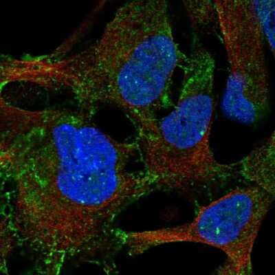 Immunocytochemistry/Immunofluorescence: P2Y9 Antibody [NBP2-68671] - Staining of human cell line AF22 shows localization to nuclear bodies & plasma membrane.