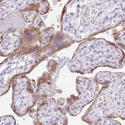 Immunohistochemistry-Paraffin: P2Y9 Antibody [NBP2-33734] - Staining of human placenta shows moderate cytoplasmic positivity in trophoblastic cells.