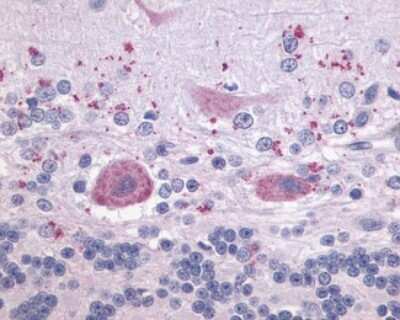 Immunohistochemistry-Paraffin: P2Y9 Antibody [NLS871] - Analysis of anti-P2Y9 antibody with human brain, cerebellum.