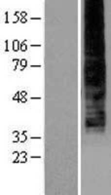 Western Blot: P2Y9 Overexpression Lysate (Adult Normal) [NBP2-04286] Left-Empty vector transfected control cell lysate (HEK293 cell lysate); Right -Over-expression Lysate for P2Y9.