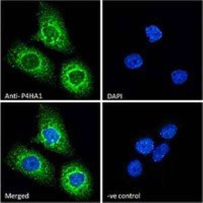 Immunocytochemistry/Immunofluorescence: P4HA1 Antibody [NB100-57852] - Immunofluorescence analysis of paraformaldehyde fixed A431 cells, permeabilized with 0.15% Triton. Primary incubation 1hr (10 ug/mL) followed by Alexa Fluor 488 secondary antibody (2 ug/mL), showing endoplasmic reticulum and cytoplasmic staining. The nuclear stain is DAPI (blue). Negative control: Unimmunized goat IgG (10 ug/mL) followed by Alexa Fluor 488 secondary antibody (2 ug/mL).