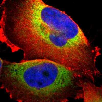 <b>Independent Antibodies Validation. </b>Immunocytochemistry/Immunofluorescence: P4HA1 Antibody [NBP1-84397] - Staining of human cell line U-251 MG shows localization to endoplasmic reticulum.