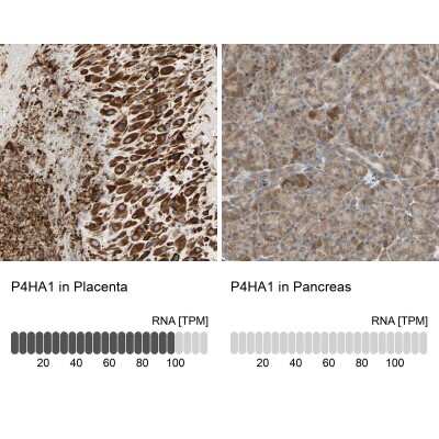 <b>Orthogonal Strategies Validation. </b>Immunohistochemistry-Paraffin: P4HA1 Antibody [NBP1-84397] - Staining in human placenta and pancreas tissues using anti-P4HA1 antibody. Corresponding P4HA1 RNA-seq data are presented for the same tissues.