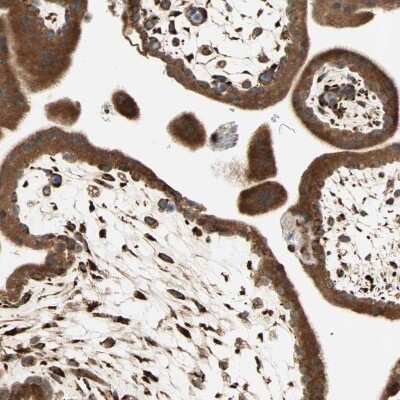 Immunohistochemistry-Paraffin: P4HA1 Antibody [NBP1-84397] - Staining of human placenta shows strong granular cytoplasmic positivity in trophoblastic cells.