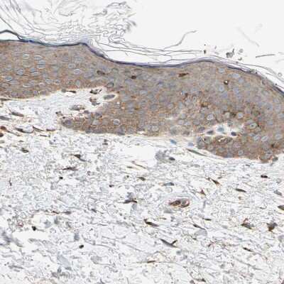 Immunohistochemistry-Paraffin: P4HA1 Antibody [NBP1-84397] - Staining of human skin shows weak granular cytoplasmic positivity in squamous epithelial cells.