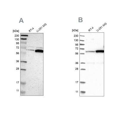 Western Blot: P4HA1 Antibody [NBP1-84397] - Analysis using Anti-P4HA1 antibody NBP1-84397 (A) shows similar pattern to independent antibody NBP1-84398 (B).