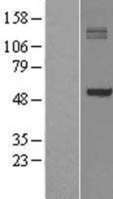 Western Blot: P4HA1 Overexpression Lysate (Adult Normal) [NBL1-14050] Left-Empty vector transfected control cell lysate (HEK293 cell lysate); Right -Over-expression Lysate for P4HA1.