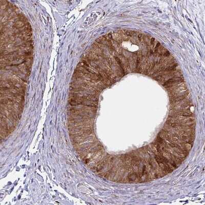 Immunohistochemistry-Paraffin: P4HA2 Antibody (CL0351) [NBP2-52922] - Staining of human epididymis shows moderate to strong cytoplasmic positivity in glandular cells.