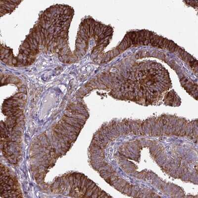 Immunohistochemistry-Paraffin: P4HA2 Antibody (CL0351) [NBP2-52922] - Staining of human fallopian tube shows moderate to strong cytoplasmic positivity in glandular cells.