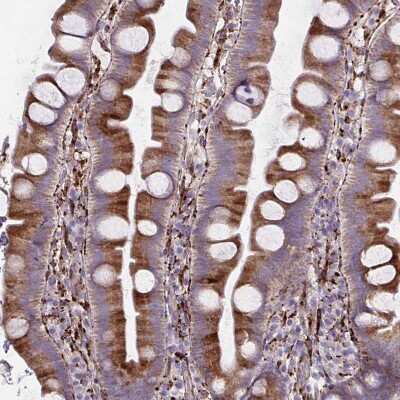 Immunohistochemistry-Paraffin: P4HA2 Antibody (CL0351) [NBP2-52922] - Staining of human small intestine shows moderate cytoplasmic positivity in glandular cells.