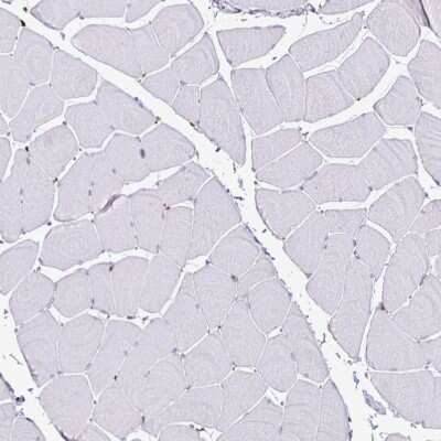 Immunohistochemistry-Paraffin: P4HA2 Antibody (CL0351) [NBP2-52922] - Staining of human skeletal muscle shows no positivity in striated muscle fibers as expected.