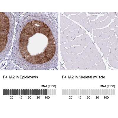 Immunohistochemistry-Paraffin P4HA2 Antibody (CL0351)