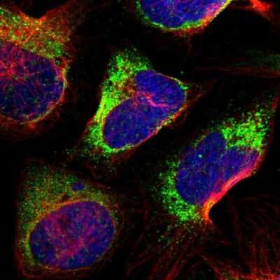 Immunocytochemistry/Immunofluorescence: P4HA2 Antibody [NBP2-33878] - Staining of human cell line U-2 OS shows localization to endoplasmic reticulum & vesicles. Antibody staining is shown in green.