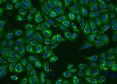 Immunocytochemistry/Immunofluorescence: P4HA2 Antibody [NBP3-06468] - Staining of P4HA2 in U2OS cells. Cells were fixed with 4% PFA, permeabilzed with 0.1% Triton X-100 in PBS,blocked with 10% serum, and incubated with rabbit anti-Human P4HA2 polyclonal antibody (dilution ratio 1:200) at 4? overnight. Then cells were stained with the Alexa Fluor®488-conjugated Goat Anti-rabbit IgG secondary antibody (green) and counterstained with DAPI (blue).Positive staining was localized to Cytoplasm.