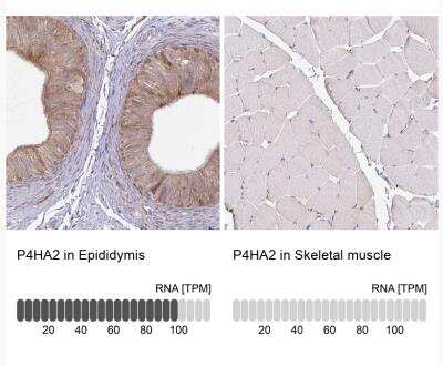 Immunohistochemistry-Paraffin P4HA2 Antibody