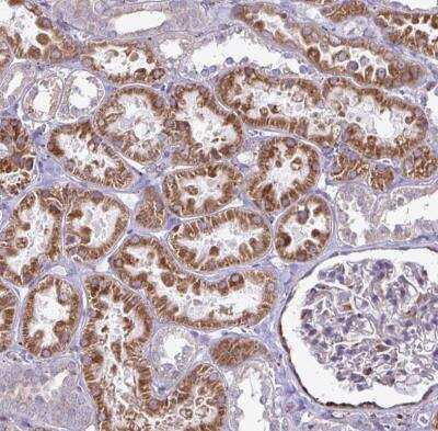 Immunohistochemistry-Paraffin: P4HA2 Antibody [NBP2-33878] - Staining of human kidney shows strong cytoplasmic positivity in cells in tubules.