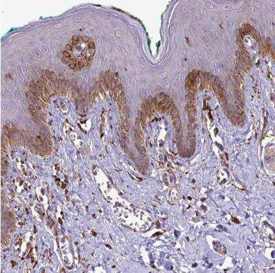 Immunohistochemistry-Paraffin: P4HA2 Antibody [NBP2-33878] - Staining of human skin shows strong cytoplasmic positivity in squamous epithelial cells.