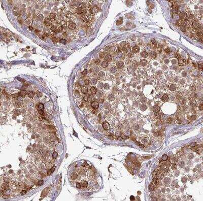 Immunohistochemistry-Paraffin: P4HA2 Antibody [NBP2-33878] - Staining of human testis shows strong cytoplasmic positivity in cells in seminiferous ducts.