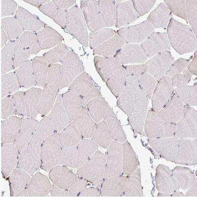 Immunohistochemistry-Paraffin: P4HA2 Antibody [NBP2-33878] - Staining of human skeletal muscle shows no positivity in myocytes as expected.