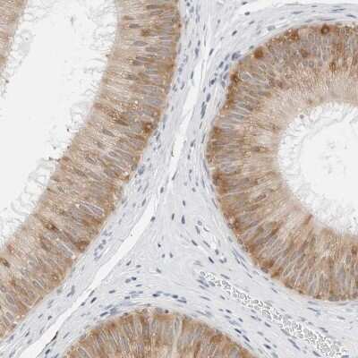 Immunohistochemistry-Paraffin: P4HA2 Antibody [NBP2-33909] - Staining of human epididymis shows high expression.