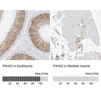 Immunohistochemistry-Paraffin: P4HA2 Antibody [NBP2-33909] - Staining in human epididymis and skeletal muscle tissues using anti-P4HA2 antibody. Corresponding P4HA2 RNA-seq data are presented for the same tissues.