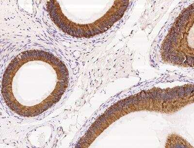 Immunohistochemistry-Paraffin: P4HA2 Antibody [NBP3-06468] - Staining of human P4HA2 in human epididymis with rabbit polyclonal antibody at 1:2000 dilution.