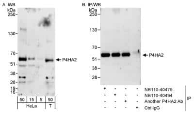 Immunoprecipitation P4HA2 Antibody