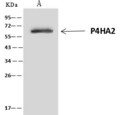 Immunoprecipitation: P4HA2 Antibody [NBP3-06468] - Lane A:0.5 mg HeLa Whole Cell Lysate4 uL anti-P4HA2 rabbit polyclonal antibody and 60 ug of Immunomagnetic beads Protein A/G.Primary antibody:Anti-P4HA2 rabbit polyclonal antibody,at 1:100 dilution Secondary antibody:Clean-Blot IP Detection Reagent (HRP) at 1:1000dilutionDeveloped using the ECL technique.Performed under reducing conditions.Predicted band size: 61 kDaObserved band size :61 kDa