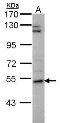 Western Blot: P4HA2 Antibody [NBP2-19665] - Sample (30 ug of whole cell lysate) A: H1299 7. 5% SDS PAGE gel, diluted at 1:1000.