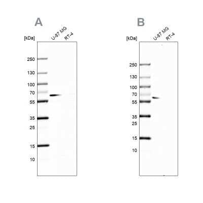 <b>Independent Antibodies Validation and Orthogonal Strategies Validation.</b>Western Blot: P4HA2 Antibody [NBP2-33909] - Analysis using Anti-P4HA2 antibody NBP2-33909 (A) shows similar pattern to independent antibody NBP2-33878 (B).