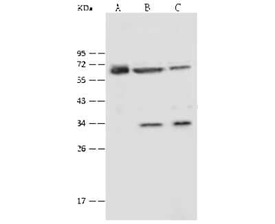 Western Blot: P4HA2 Antibody [NBP2-99486] - Anti-P4HA2 rabbit polyclonal antibody at 1:2000 dilution. Lane A: U251 MG Whole Cell Lysate Lane B: HeLa Whole Cell Lysate Lane C: H1299 Whole Cell Lysate Lysates/proteins at 30 ug per lane. Secondary Goat Anti-Rabbit IgG (H+L)/HRP at 1/10000 dilution. Developed using the ECL technique. Performed under reducing conditions. Predicted band size: 61 kDa