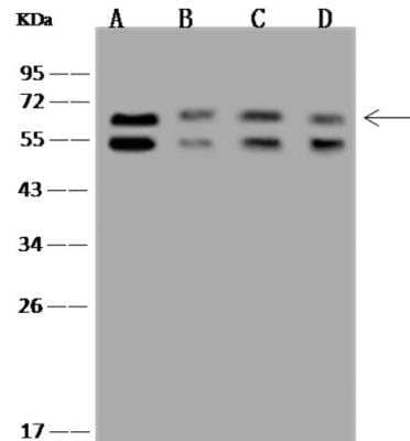 Western Blot: P4HA2 Antibody [NBP3-06468] - Lane A: HeLa Whole Cell LysateLane B: H1299 Whole Cell LysateLane C: 293T Whole Cell LysateLane D: PC12 Whole Cell LysateLysates/proteins at 30 ug per lane.SecondaryGoat Anti-Rabbit IgG (H+L)/HRP at 1/10000 dilution.Developed using the ECL technique.Performed under reducing conditions.Predicted band size:61 kDaObserved band size:61 kDa(We are unsure as to the identity of these extra bands.)