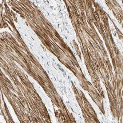 Immunohistochemistry-Paraffin P4HA3 Antibody