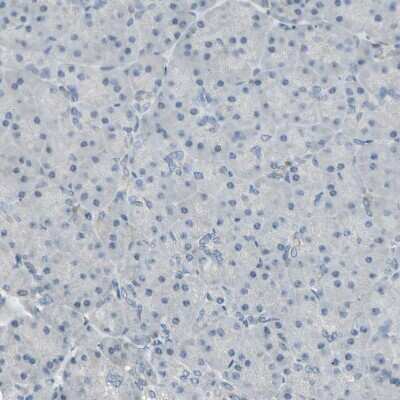 Immunohistochemistry-Paraffin P4HA3 Antibody