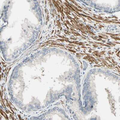 Immunohistochemistry-Paraffin P4HA3 Antibody