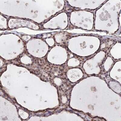 Immunohistochemistry-Paraffin: PA1 Antibody [NBP1-89792] - Staining of human thyroid gland shows moderate cytoplasmic positivity in glandular cells.