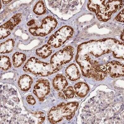 Immunohistochemistry-Paraffin: PA1 Antibody [NBP1-89793] - Staining of human kidney shows strong cytoplasmic positivity in cells in renal tubules.