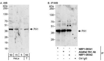 Western Blot: PA1 Antibody [NBP1-06541] - Whole cell lysate from HeLa and 293T cells. PA1 was also immunoprecipitated by another rabbit anti-PA1 antibody and NBP1-06542.