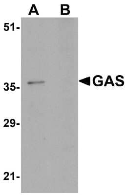 Western Blot: PA1 Antibody [NBP1-76239] - EL4 cell lysate in (A) the absence and (B) the presence of blocking peptide with PA1 antibody at 1ug/mL.