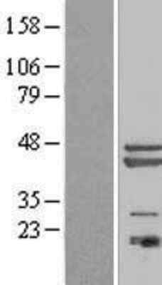 Western Blot: PA1 Overexpression Lysate (Adult Normal) [NBL1-08216] Left-Empty vector transfected control cell lysate (HEK293 cell lysate); Right -Over-expression Lysate for PA1.